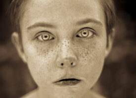 Fritz-Liedtke photogravure freckles