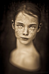 Fritz-Liedtke photogravure freckles
