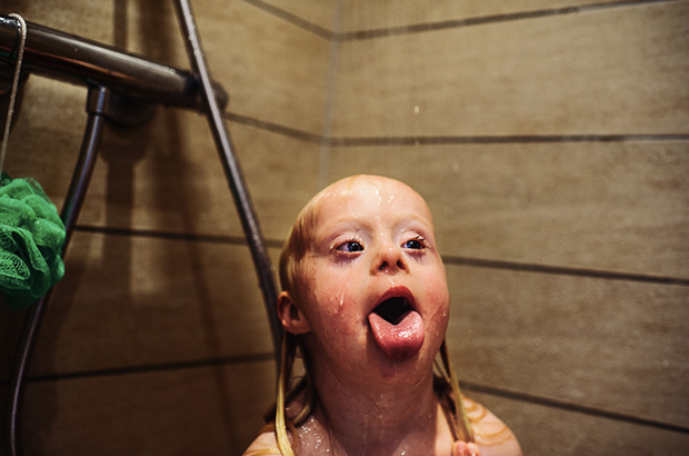 Beautiful Photos Document The Daily Life Of A Little Girl With Down Syndrome Living In The Denmark Countryside Feature Shoot