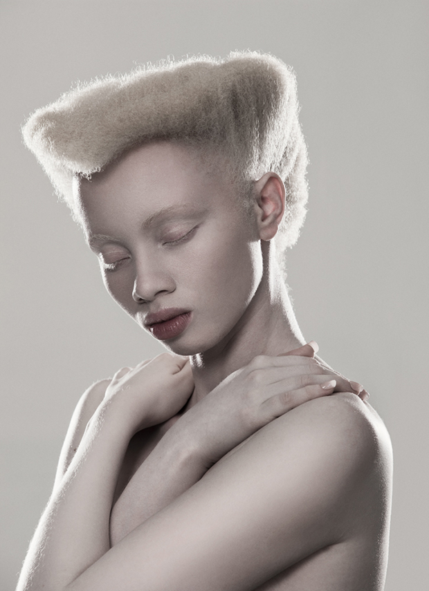 In South Africa One Photographer Breaks The Taboo Surrounding Albinism Feature Shoot