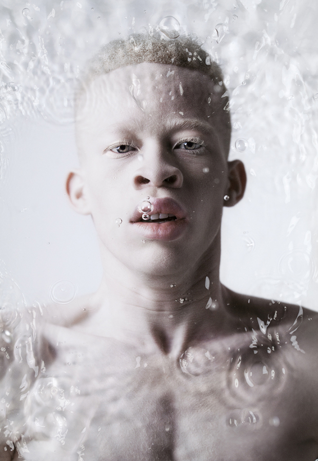 In South Africa One Photographer Breaks The Taboo Surrounding Albinism Feature Shoot